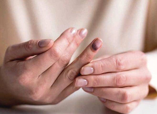 تست‌های جالب سلامتی/ در ۳۰ ثانیه از سلامت بدن خود باخبر شوید!