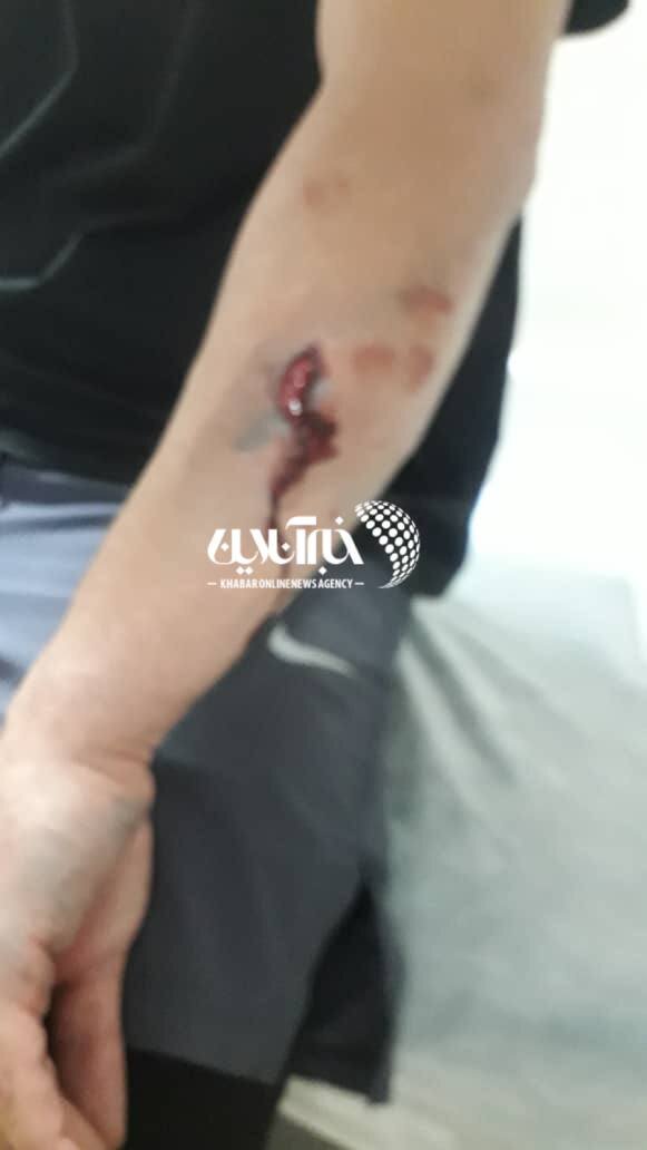 عکس| سارق‌ها به ستاره سابق پرسپولیس حمله کردند/ کار آقای فوتبالیست به بیمارستان کشیده شد