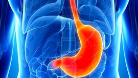 عدم درمان رفلاکس بعد از دو سالگی باعث ماندگار این بیماری می شود