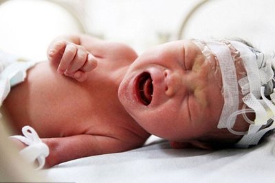 تشنج همان تغییرات ناگهانی در رفتار و حرکات طبیعی کودک است
