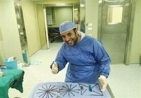 خارج شدن ۳۹ میخ فندک و قیچی از معده یک بیمار