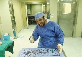 خارج شدن ۳۹ میخ فندک و قیچی از معده یک بیمار