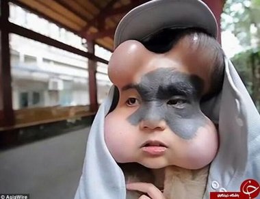 شکل عجیب صورت دختر چینی سوژه رسانه‌ها شد