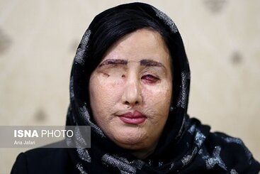 عیادت نماینده مجلس از سهیلاجورکش