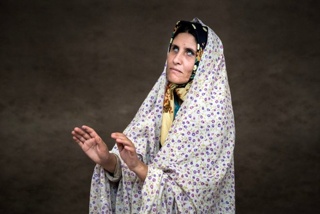 معضل ژنتیکی عجیب در خراسان شمالی