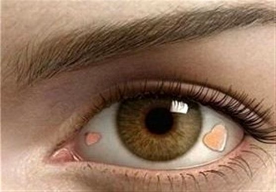 کاشت نگین ۷ میلیونی در چشم !