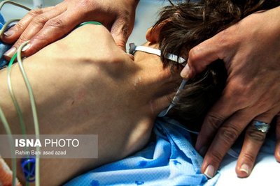 وضعیت ابوالفضل کوچولو پس از شکنجه ناپدری