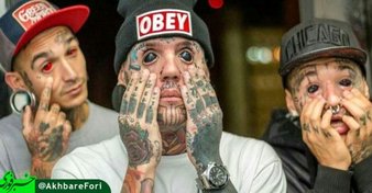 خالکوبی کره چشم!