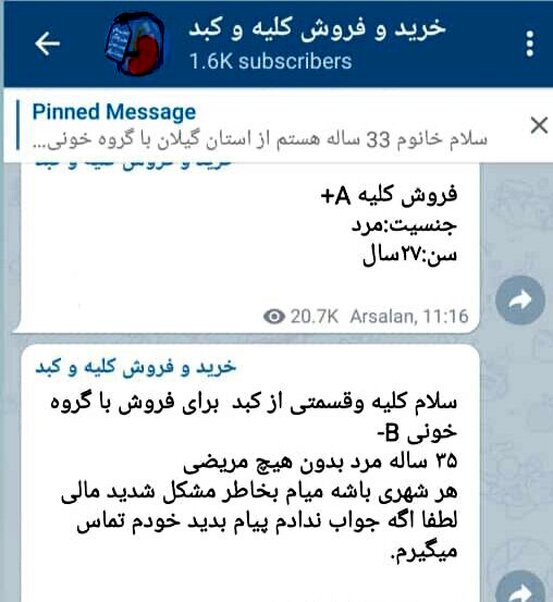 فروش عضو به قیمت امرار معاش!