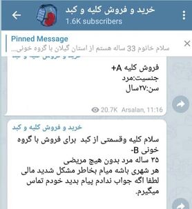 فروش عضو به قیمت امرار معاش!