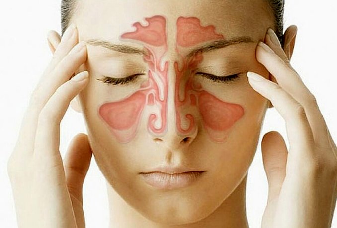 علت بروز انواع سردردها چیست؟