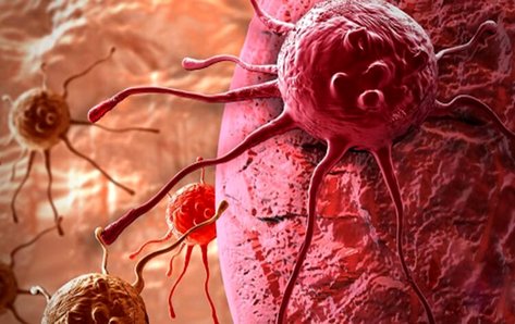 کدام علائم نشانه بروز سرطان است؟