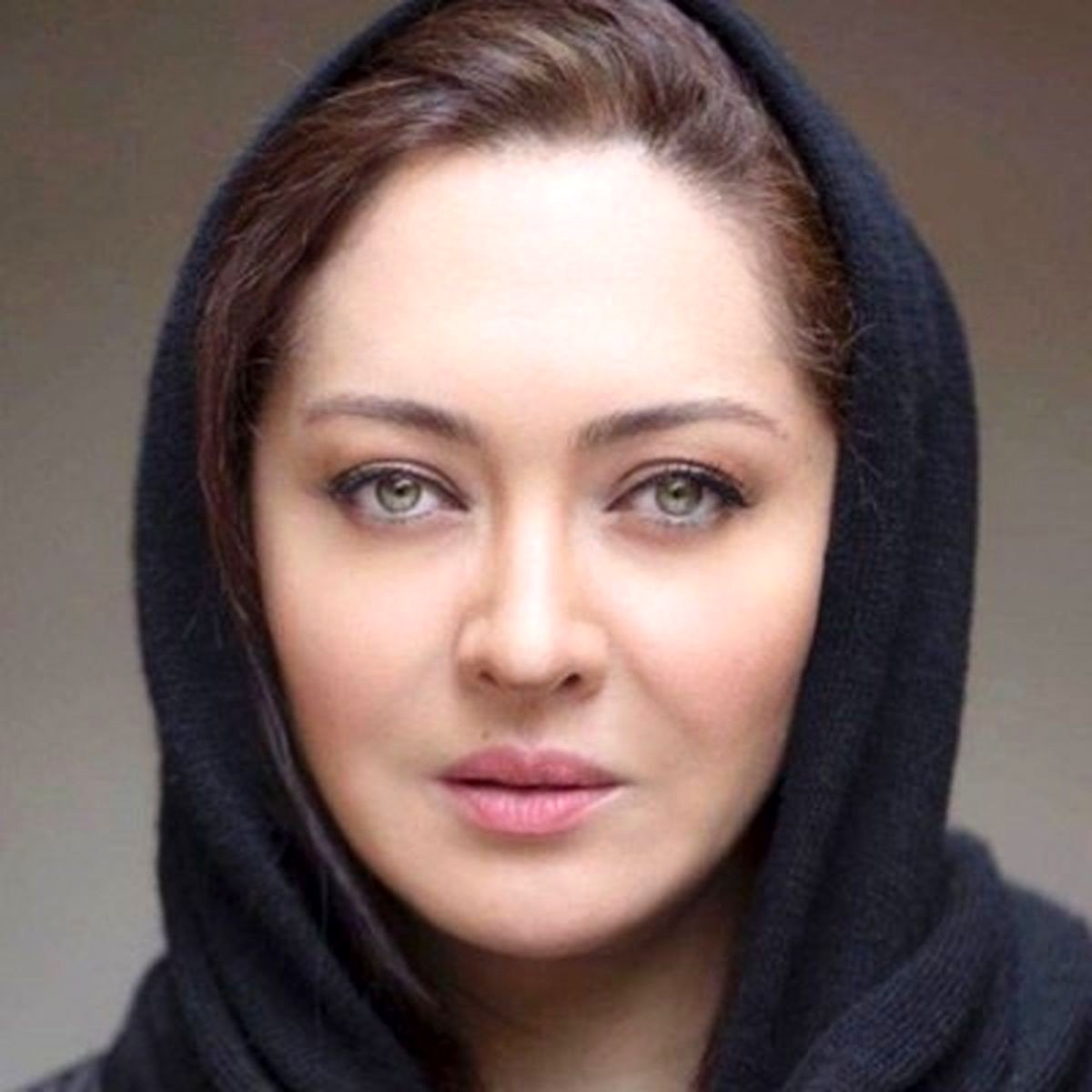 حادثه برای نیکی کریمی در خوزستان / جزییات صدمات جسمی