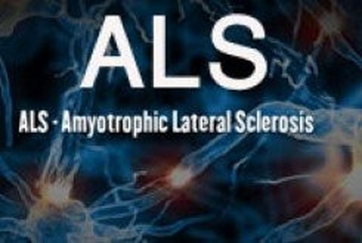 هزینه ۲۰ میلیونی بیماران "ای ال اس" در ماه