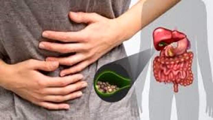 علائم کولسیستیت و روش‌های درمان