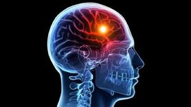 هنگام سکته مغزی پیش از رسیدن اورژانس چه کنیم؟