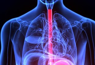 رفلاکس معده چیست؟ 9 راه پیشگیری از رفلاکس معده