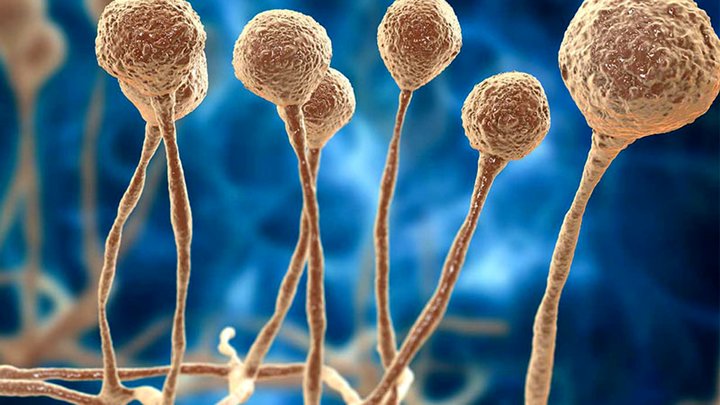 قارچ سیاه، دستیار مرگبار کرونا در موج دلتا