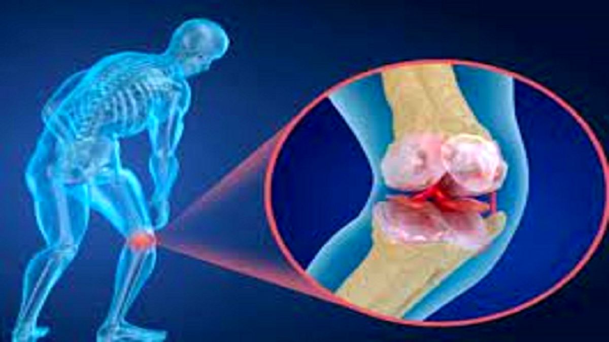 پوکی استخوان چه زمان در زنان شروع می‌شود؟
