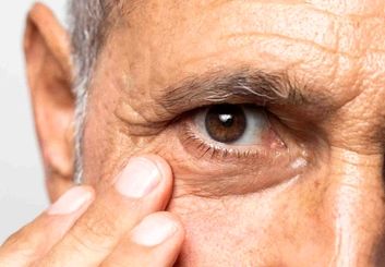 پیرچشمی چیست و چگونه درمان می‌شود؟ | علائم، علل و راهکارهای مؤثر