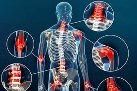 آرتروز چیست؟ | علائم، علل، درمان و روش‌های پیشگیری