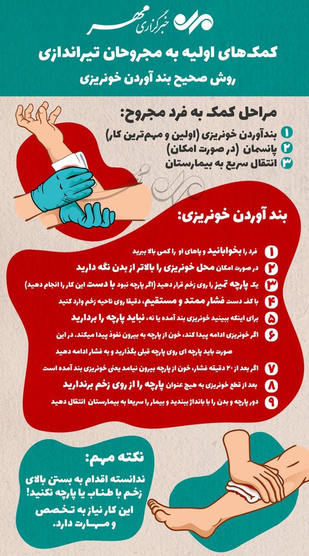 کمک‌های اولیه به مجروحان تیراندازی/روش صحیح بند آوردن خونریزی
